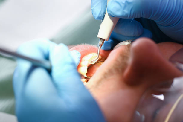 Best Tooth Infection Emergency Dentist  in Gibbstown, NJ