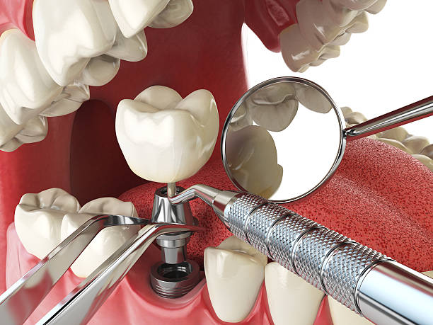 Best Knocked-Out Tooth Emergency  in Gibbstown, NJ