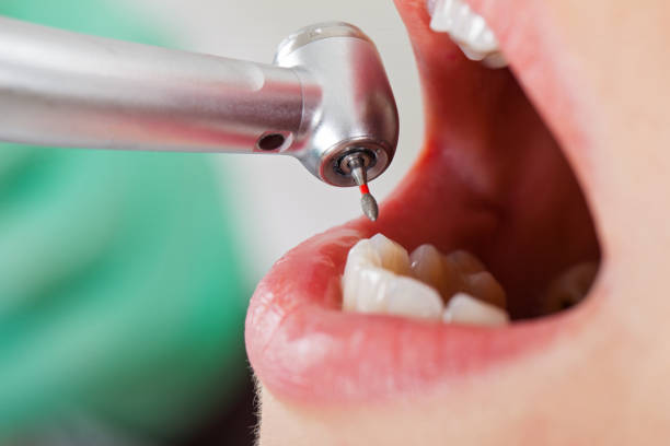 Best Broken Tooth Emergency  in Gibbstown, NJ